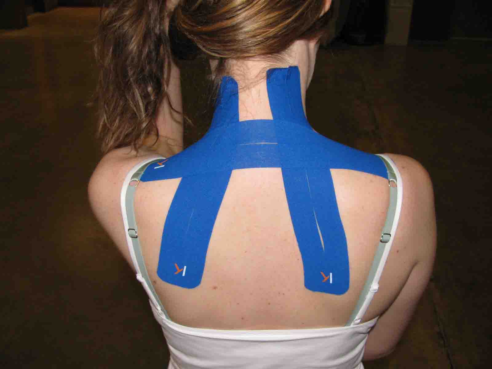 sports tape sore muscles taped runners put kinesiology austin daily austinchronicle
