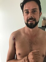 Guitarist Shot After a Show Friday